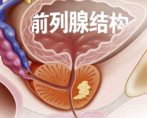 广州试管婴儿代孕大概多少钱|松原输卵管闭塞可以做三代试管吗？