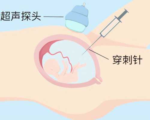 广州三大试管代怀医院|试管婴儿可以选择生龙凤胎吗,成功率有多少(试管婴儿一
