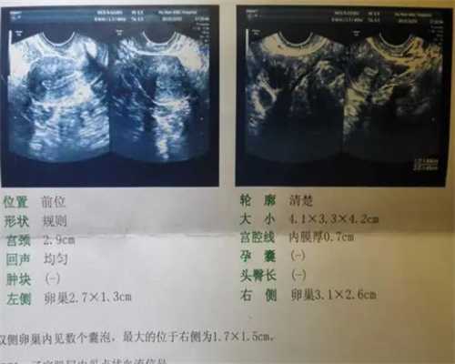 广州代生医院官网,在试管婴儿治疗前可进行中医调理_子宫膜过后可以吃凉拌青