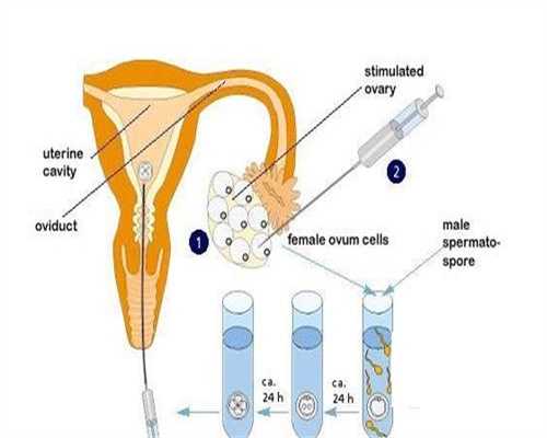 代孕一定要掌握的补钙方法_广州代孕成功率