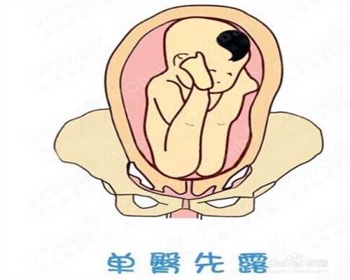 广州医院供卵_广州绝经后能做供卵试管吗_22周胎儿肾多大是正常值