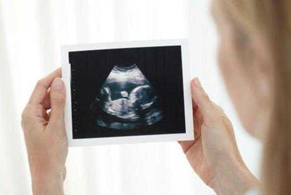广州供卵选性别生女孩 广州中山六院生殖医学中心 ‘孕三十二周怀男孩症状’