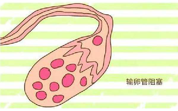 代生公司广州助孕 广州试管成功率高的医院： ‘男孩胎动症状’